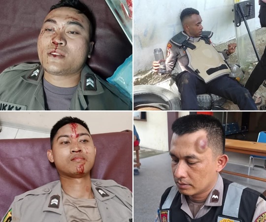 Demo Tak Berijin Berujung Ricuh, 4 Personel Jadi Korban, Satu Truck Polri Dibakar